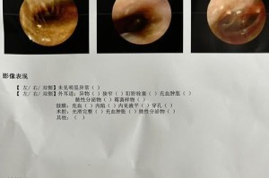 耳朵发炎怎么治？掏耳朵的正确方法及药物推荐（清晰听见声音的秘诀，掏耳朵离不开它）