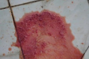 狗拉血的原因及应急处理方法（了解狗拉血的主要原因，以及如何应对这种情况）
