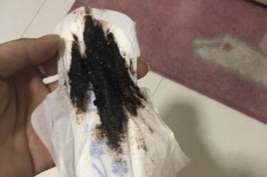 狗狗月经量的注意事项（关于狗狗月经量的健康关注点）