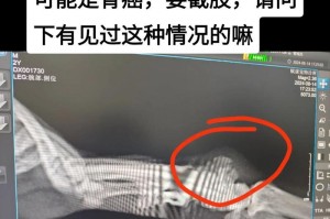 猫腿受伤的康复期长短与恢复速度（解读猫腿受伤的康复时间以及关键因素）