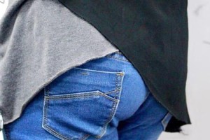 屁眼周围长毛的原因及解决方法（探索为什么屁眼周围也会长毛，以及如何有效解决这一问题）