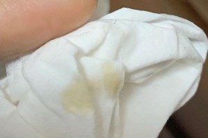 猫屁股粘了白色的东西？了解猫咪体质中的常见问题（探讨猫咪健康问题和可能的解决方案）