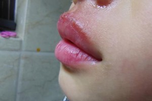 流鼻涕的原因及应对方法（为什么我老是流鼻涕？如何有效缓解流鼻涕症状？）