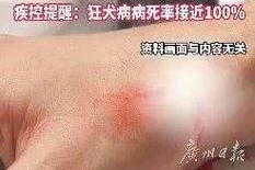 狂犬病的症状揭秘（掌握狂犬病的关键症状，保护您和家人的安全）