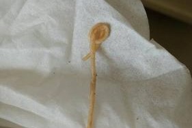 狗狗突然吐打什么针？（了解狗狗突然呕吐的原因和预防方法）