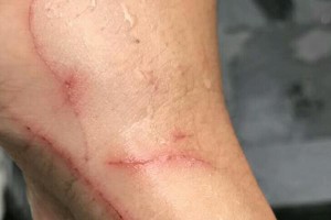以大鳄换水的注意事项（保护大鳄健康的关键）