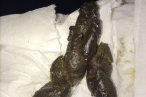 健康的泰迪犬的排便频率及如何处理便秘问题（泰迪犬每天排便次数多少？如何解决泰迪犬便秘问题？）
