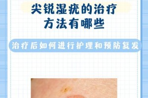 某病的传染途径及预防方法（探究某病的传播途径，提供科学有效的预防方法）