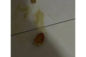 狗狗误吞异物怎么办？三步处理救命方法！（急救方法与重要注意事项，立即行动是关键）